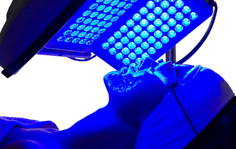How Blue Light Therapy Can Help You Get Rid of Acne?
