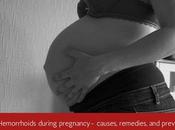 Hemorrhoids During Pregnancy?