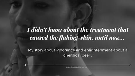 My Story of Choosing A Gel-Based At-Home Chemical Peel That You Would Relate With (Probably)