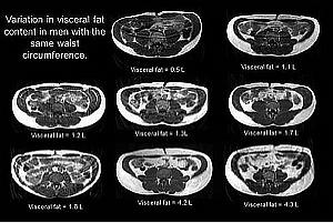 The Scale and Its Other Liar Acolytes