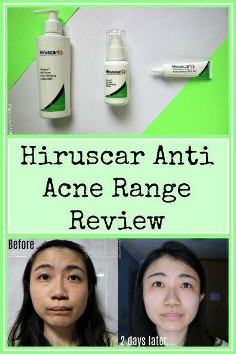 See acne improvement with Hiruscar Anti Acne Range | Sponsored