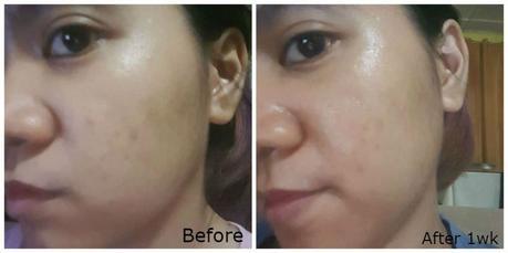 Get Healthy-Looking Skin: Klairs Freshly Juiced Vitamin E Mask Review