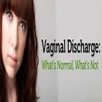 WHEN IS MY VAGINAL DISCHARGE NORMAL?