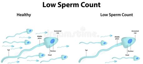 What is a Low Sperm Count?