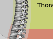 Facts About Hyperkyphosis