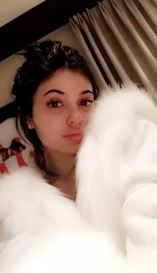 Here’s the $17 Acne Treatment Kylie Jenner Uses for Lustrous Skin
