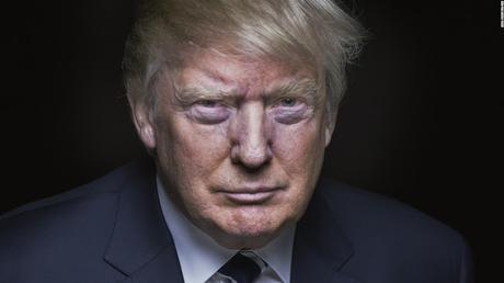 Donald Trump May Have A Degenerative Brain Disease