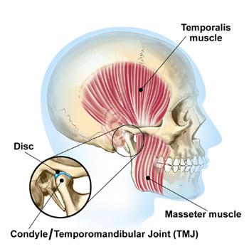 Could You Be Suffering From TMJ?