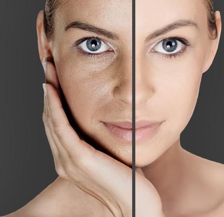 How Microdermabrasion Works Great For Skin Rejuvenation