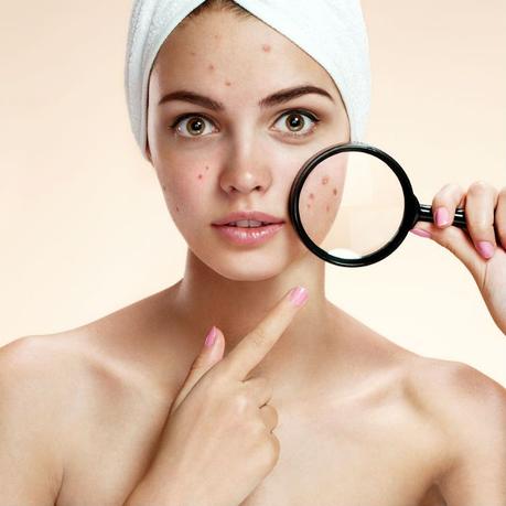 7 Deadly Sins of People with Acne-Prone Skin