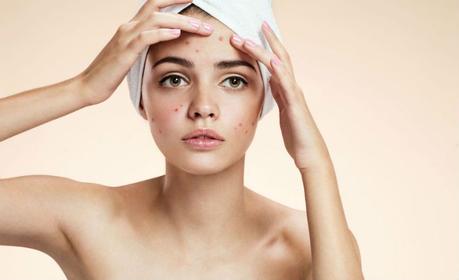 7 Deadly Sins of People with Acne-Prone Skin