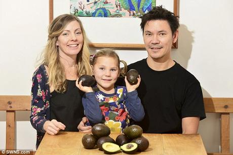 How ‘two avocados a day’ dramatically improved this girl’s epilepsy