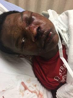 Grand jury in Troy, AL, lets cops off the hook in KeAndre Wilkerson beating, but a federal investigation still could heap severe punishment on officers