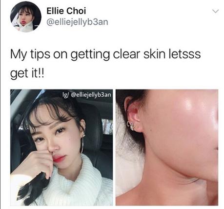 How To Achieve Glass Skin With Problematic Skin?
