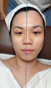 Lash Regrowth: Signature Yuan Yang Facial