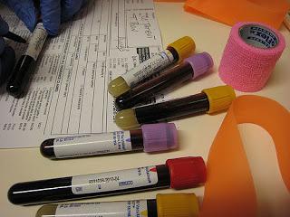 Blood Urea Nitrogen: Biomarker of Health and Longevity