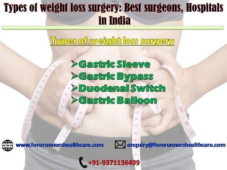 Types of weight loss surgery: Best surgeons, Hospitals in India