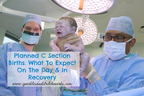 Planned C Section Births: What To Expect On The Day & In Recovery