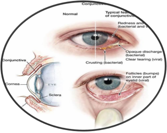 Avail the advanced eye surgery India Seeking the Top Surgeon at Best Hospital