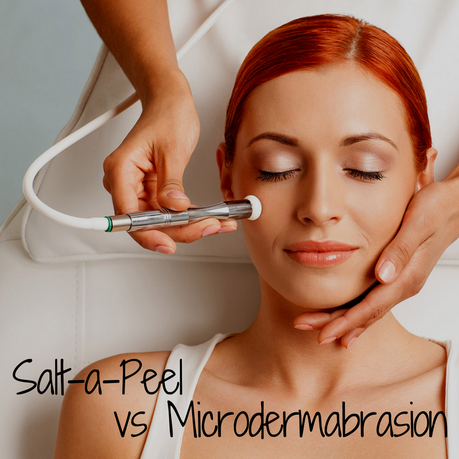 Salt-a-Peel vs Microdermabrasion