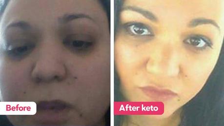 The keto diet: “I have come back from the dead”