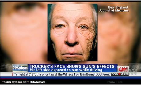 effects of sun exposure