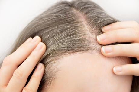 Home remedies to prevent graying of hair 
