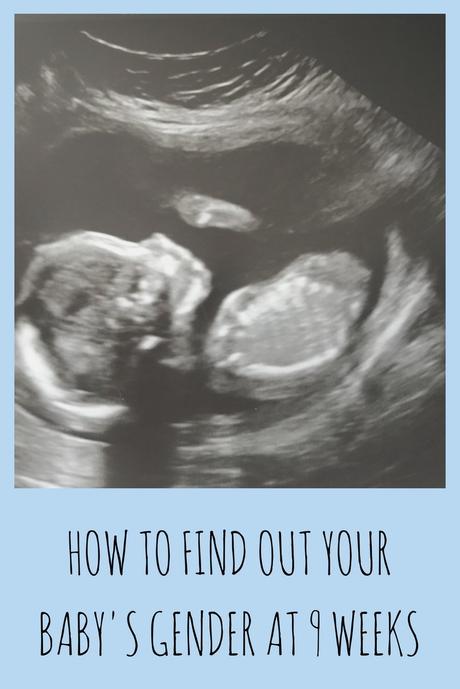 How to find out your baby's gender at 9 weeks