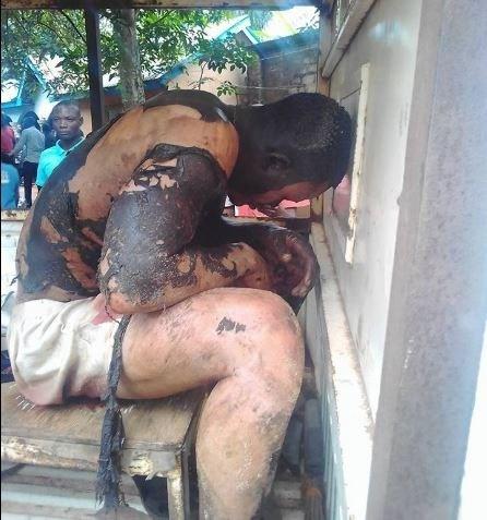 Man Gets Badly Burnt While Allegedly Trying To Steal From A Transformer (Graphic Photos/Video)