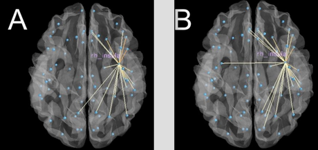 Mindfulness training increases strength of right insula connections.