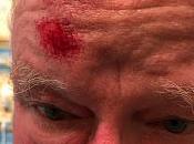 After Fall (and Notes Last Night's Troll This Blog)