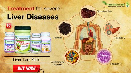 Treatment for Severe Liver Diseases with Ayurveda – Signs & Symptoms