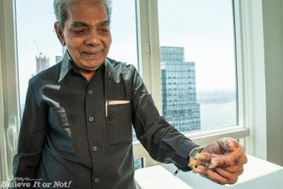 Meet Man With World’s Longest Fingernails, Finally Cuts It After 66 Years (Photos)