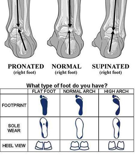 Foot Type Chart - Pronation, Neutral, Supination