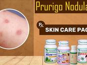 Treatment Prurigo Nodularis with Ayurveda Symptoms Diagnosis
