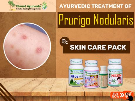 Treatment of Prurigo Nodularis with Ayurveda – Symptoms & Diagnosis