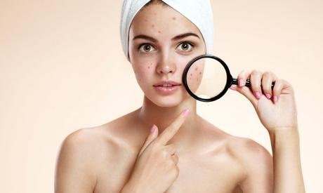 8 Surprising things that make your skin break out!