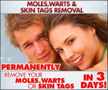 Skin Mole, Warts & Skin Tags Removal™