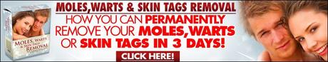 Skin Mole, Moles, Warts & Skin Tags Removal™