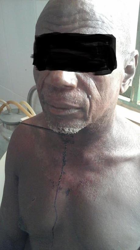 Fulani Man Escapes With Sharp Object In His Throat After Militia Attack In Taraba (Graphic Photos)
