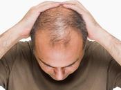Male Pattern Baldness Caused Elevated Insulin?