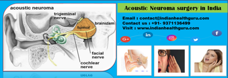 Acoustic neuroma surgery, success rates and best hospital rates in India