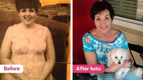 The keto diet:  I became free and beautiful