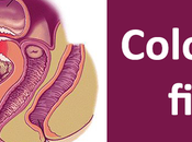 Treatment Colovesical Fistula with Herbal Remedies