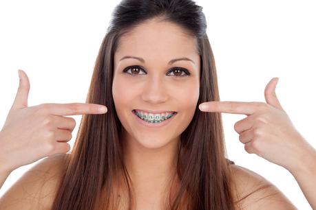 Types of braces and the right age to put them