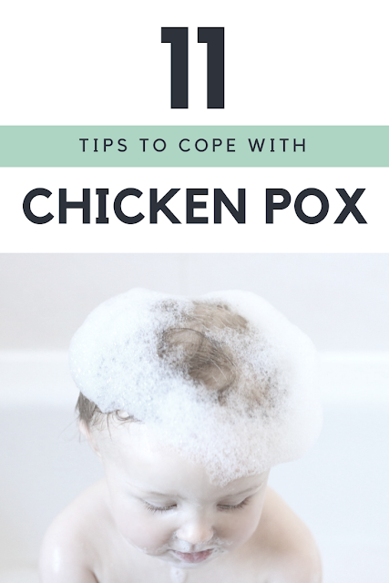 Top Tips on how to cope with Chicken Pox