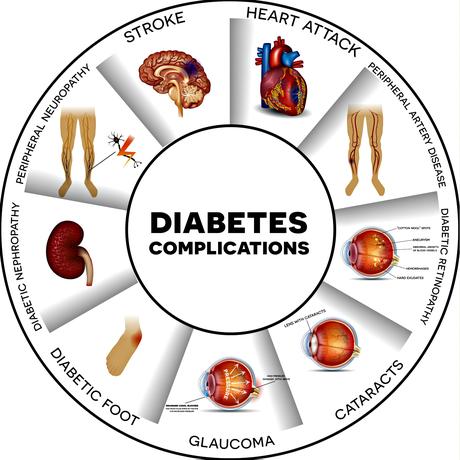 Image result for complications of diabetes type 2
