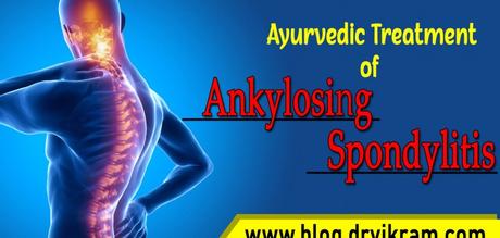 Herbal Remedies for Ankylosing Spondylitis – Symptoms and Diagnosis
