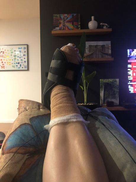 Why I Decided to Have Bunion Surgery