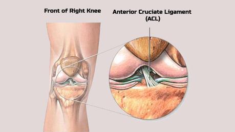 Ayurvedic Treatment of Anterior Cruciate Ligament Injury
